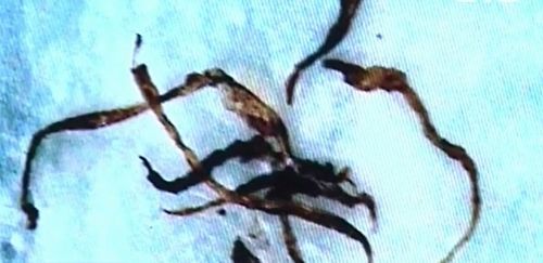 莫吉隆斯病确实存在，且可能与转基因生物有关