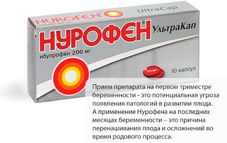 怀孕期间使用 Nurofen