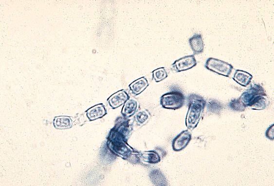 副球囊菌是副球菌病的致病因子